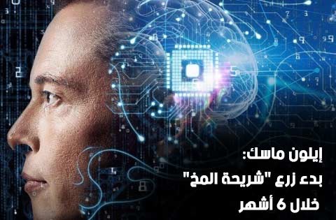 إيلون ماسك: بدء زرع "شريحة المخ" خلال 6 أشهر