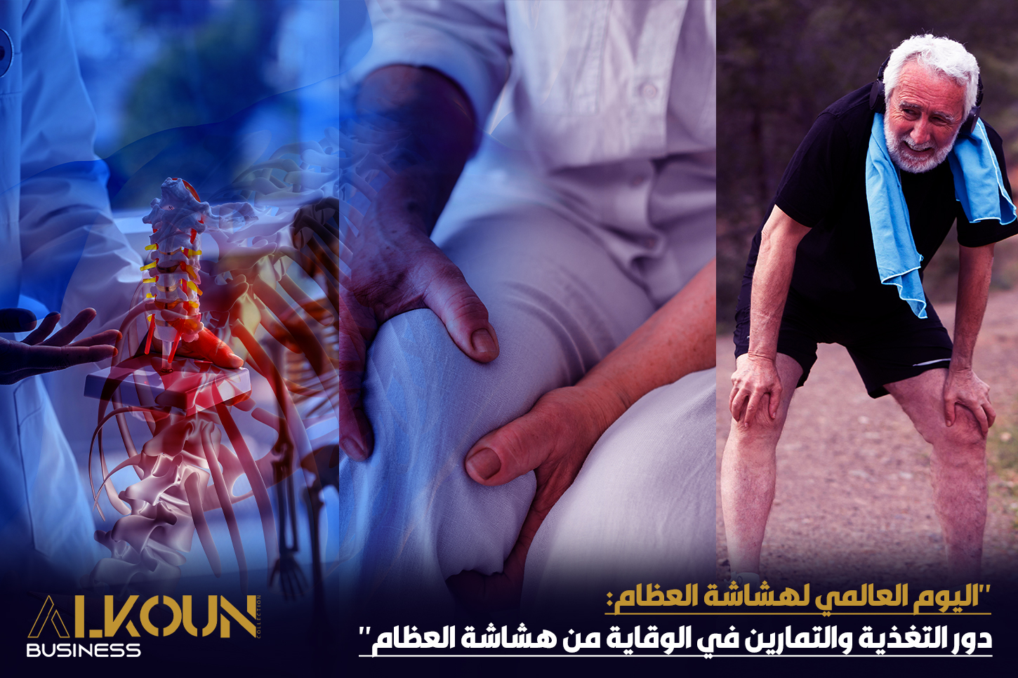"اليوم العالمي لهشاشة العظام: دور التغذية والتمارين في الوقاية من هشاشة العظام"